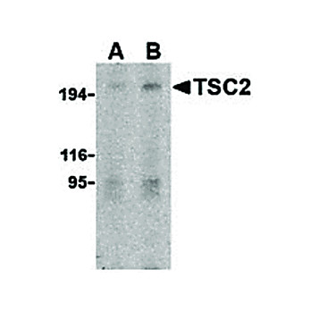TSC2 Antibody nterm 100µg