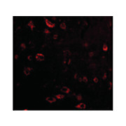 TIGAR Antibody internal 100µg