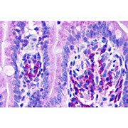 VARP Antibody internal 100µg