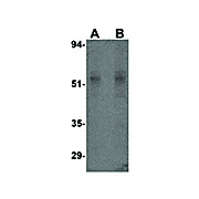 STEAP4 Antibody 100µg