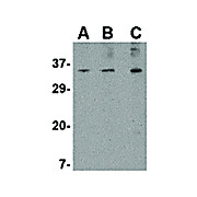 Anti-ORAI3 (RABBIT) Antibody, 100µg, Liquid (sterile filtered)
