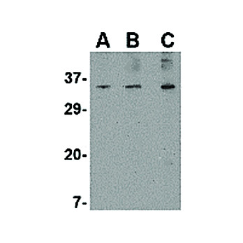 Anti-ORAI3 (RABBIT) Antibody, 100µg, Liquid (sterile filtered)
