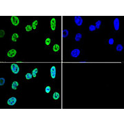 Anti-Histone H3 [Trimethyl Lys4] (RABBIT) Antibody, 50µg, Liquid (sterile filtered)