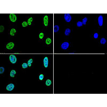 Anti-Histone H3 [Trimethyl Lys4] (RABBIT) Antibody, 50µg, Liquid (sterile filtered)