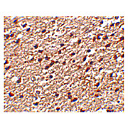 Stk39 Antibody cterm 100µg