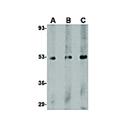 TEM7 Antibody cterm 100µg