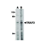 TRAF3 Antibody nterm 100µg