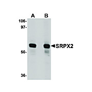 Anti-SRPX2 (RABBIT) Antibody, 100µg, Liquid (sterile filtered)