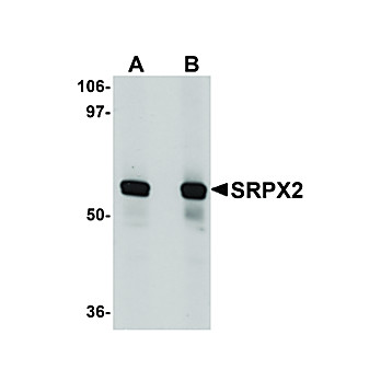 Anti-SRPX2 (RABBIT) Antibody, 100µg, Liquid (sterile filtered)