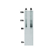 TNPO3 Antibody 100µg