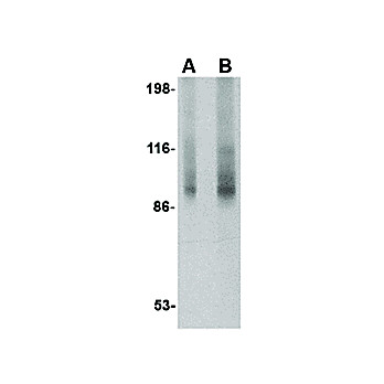 TNPO3 Antibody 100µg