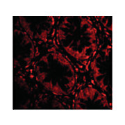TEM2 Antibody cterm 100µg