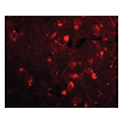 Slitrk2 Antibody cterm 100µg