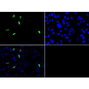 Anti-Histone H3 [Asym-dimethyl Arg2] (RABBIT) Antibody, 50µg, Liquid (sterile filtered)