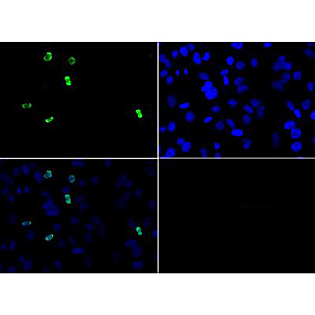 Anti-Histone H3 [Asym-dimethyl Arg2] (RABBIT) Antibody, 50µg, Liquid (sterile filtered)