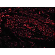 TIM-1 Antibody nterm 100µg