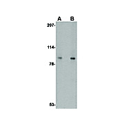 VPS53 Antibody 100µg