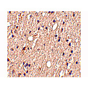 Spred1 Antibody internal 100µg
