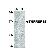 TNFRSF14 Antibody cterm 100µg