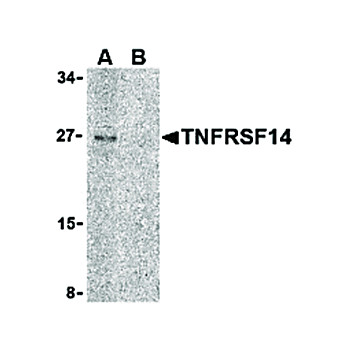 TNFRSF14 Antibody cterm 100µg