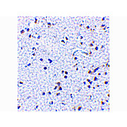 TSLP Antibody cterm 100µg