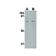 Anti-ZBTB1 (RABBIT) Antibody, 100µg, Liquid (sterile filtered)