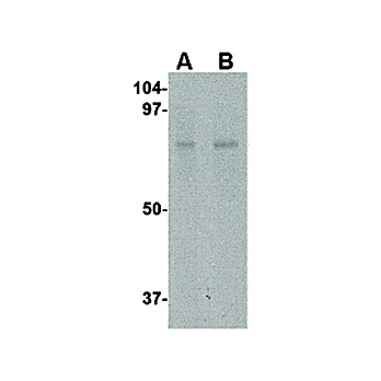 Anti-ZBTB1 (RABBIT) Antibody, 100µg, Liquid (sterile filtered)