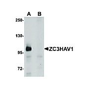 Anti-ZC3HAV1 (RABBIT) Antibody, 100µg, Liquid (sterile filtered)