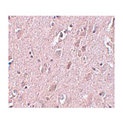 Anti-ZC3H12B (RABBIT) Antibody, 100µg, Liquid (sterile filtered)
