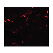 Anti-TCTN1 (RABBIT) Antibody, 100µg, Liquid (sterile filtered)