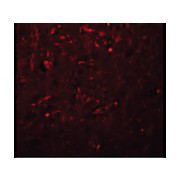 Anti-TRESK (RABBIT) Antibody, 100µg, Liquid (sterile filtered)