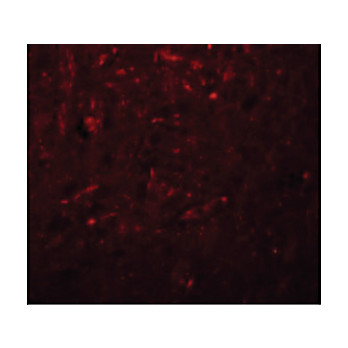 Anti-TRESK (RABBIT) Antibody, 100µg, Liquid (sterile filtered)