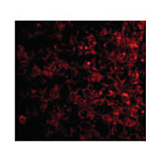 TSLP Receptor Antibody 100µg