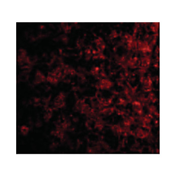 TSLP Receptor Antibody 100µg