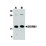 Anti-ZCRB1 (RABBIT) Antibody, 100µg, Liquid (sterile filtered)
