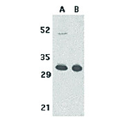 Anti-TACI (RABBIT) Antibody, 100µg, Liquid (sterile filtered)