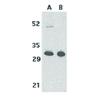 Anti-TACI (RABBIT) Antibody, 100µg, Liquid (sterile filtered)