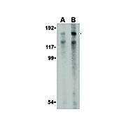 Anti-TRBP1 (RABBIT) Antibody, 100µg, Liquid (sterile filtered)