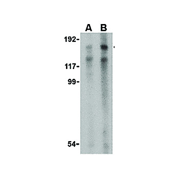 Anti-TRBP1 (RABBIT) Antibody, 100µg, Liquid (sterile filtered)