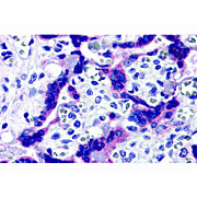 Anti-TTBK2 (RABBIT) Antibody, 100µg, Liquid (sterile filtered)