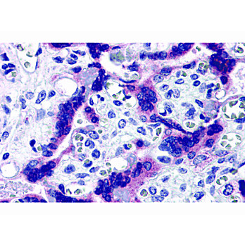 Anti-TTBK2 (RABBIT) Antibody, 100µg, Liquid (sterile filtered)