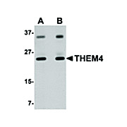 Anti-THEM4 (RABBIT) Antibody, 100µg, Liquid (sterile filtered)