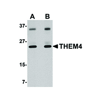 Anti-THEM4 (RABBIT) Antibody, 100µg, Liquid (sterile filtered)