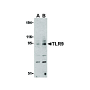 Anti-TLR9 (RABBIT) Antibody, 100µg, Liquid (sterile filtered)