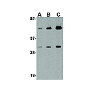 Anti-TDP43 (RABBIT) Antibody, 100µg, Liquid (sterile filtered)