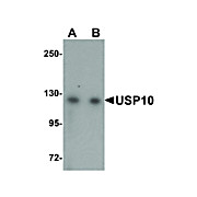 Anti-USP10 (RABBIT) Antibody, 100µg, Liquid (sterile filtered)