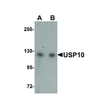 Anti-USP10 (RABBIT) Antibody, 100µg, Liquid (sterile filtered)