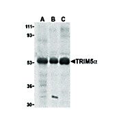 TRIM5 alpha Antibody hu 100µg