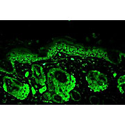 Mn SOD Antibody rat 100µg