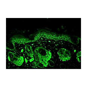 Mn SOD Antibody rat 100µg
